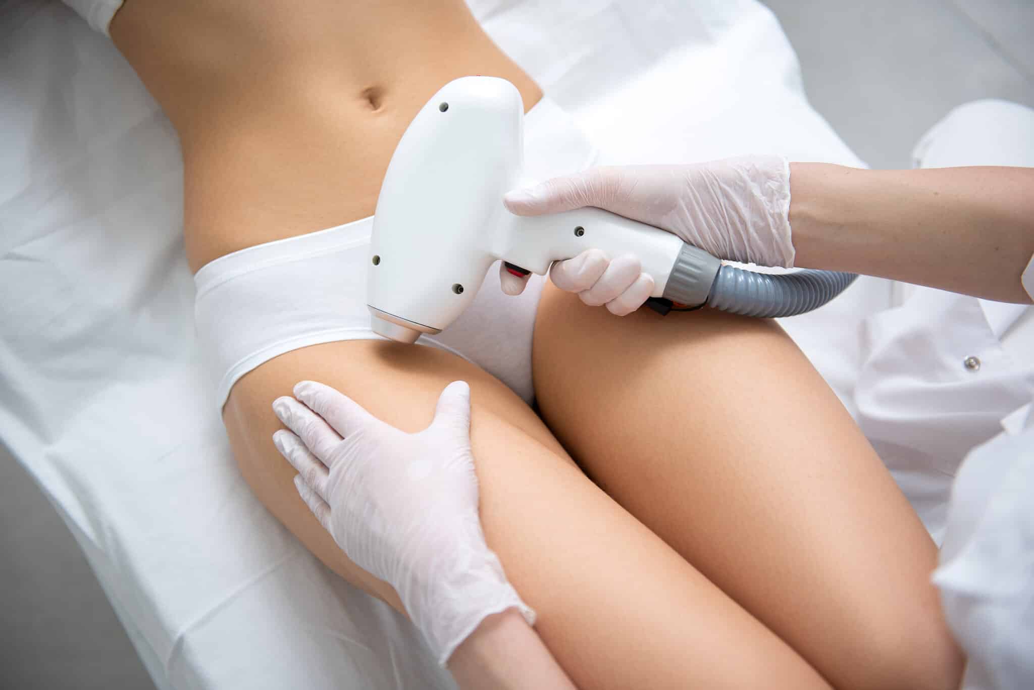 Read more about the article Bikini epilacija: trajna gladkost na intimnem predelu